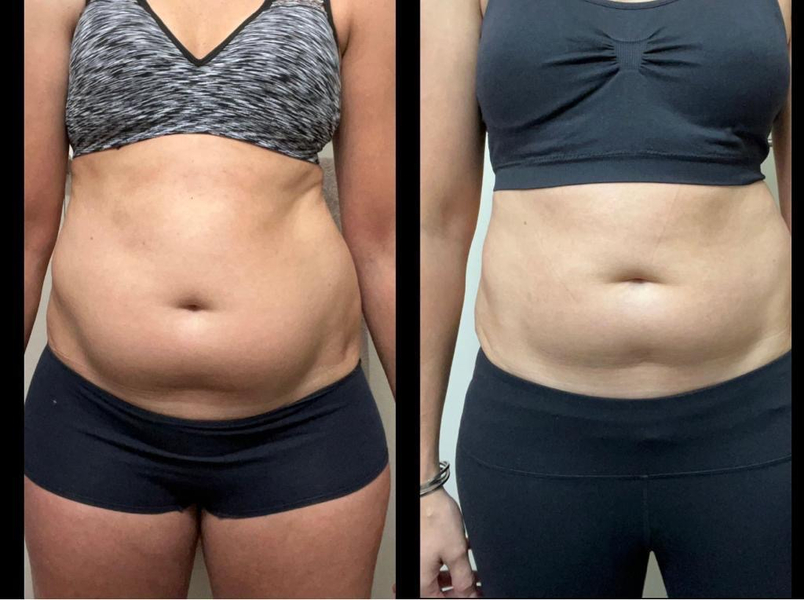 Cover photo of Lucy Cryo Services